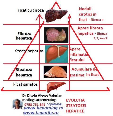 Regim alimentar in steatoza hepatica