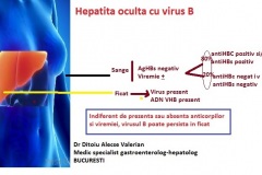 hepatita-oculta-b