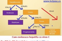 Evolutia-hepatitei-cu-virus-C